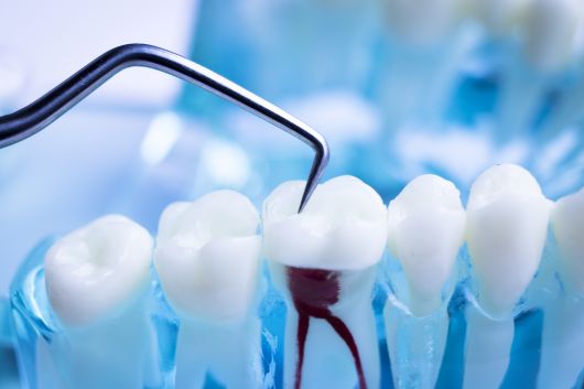 Non-Surgical Endodontics