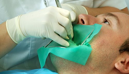 Dental Procedure